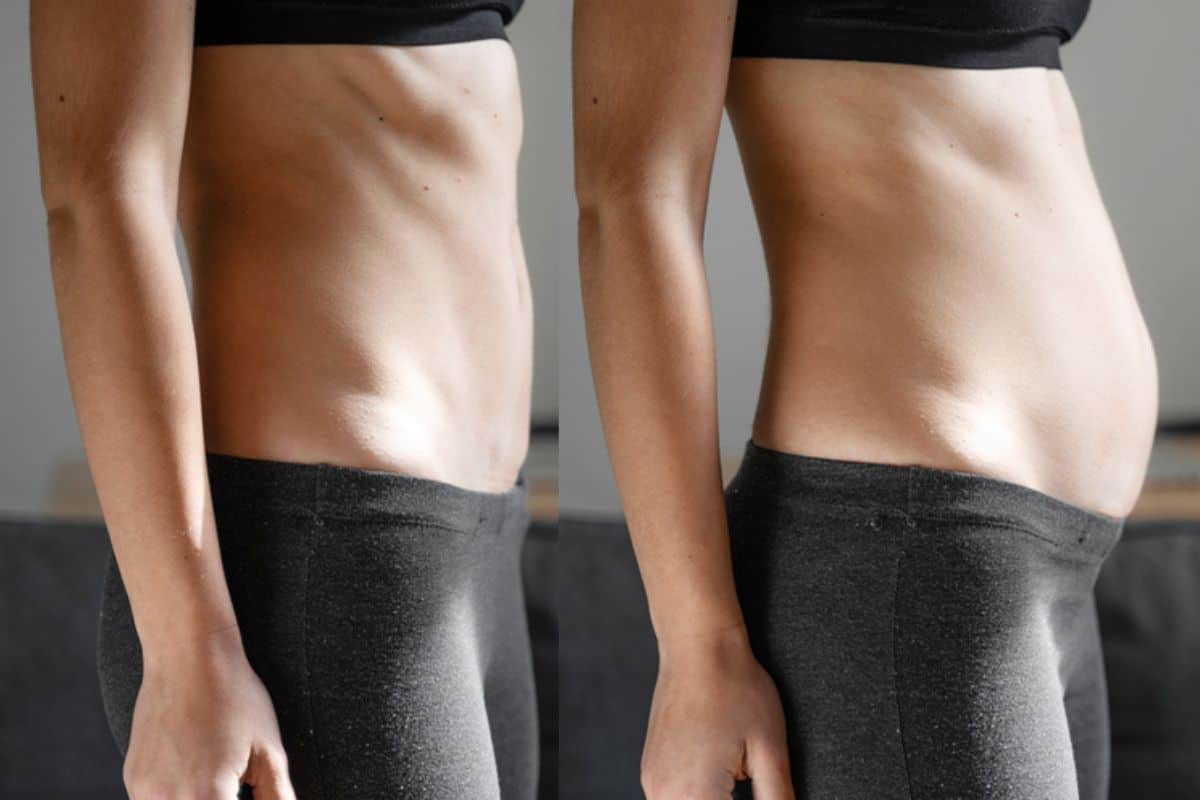 How long does diastasis recti take to improve Fulwell?