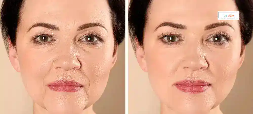 Why Aren’t My Skincare Products Making My Sagging Skin Look Firmer Fulwell?