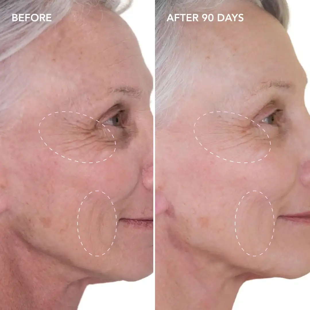 When will you see results Fulwell